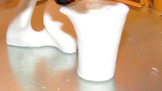 Invento nacional: el argentino que imprime en 3D sus propios huesos